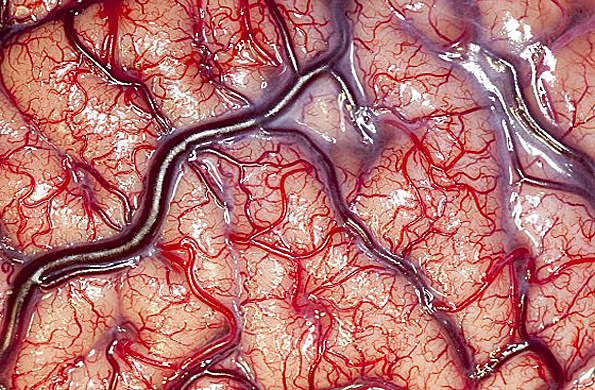 post foto de cerebro humano vivo gana premio fotográfico